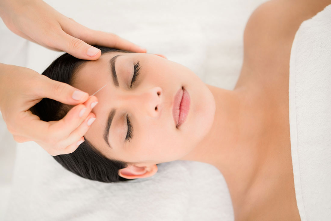 Natural Sleep Restoration with Acupuncture